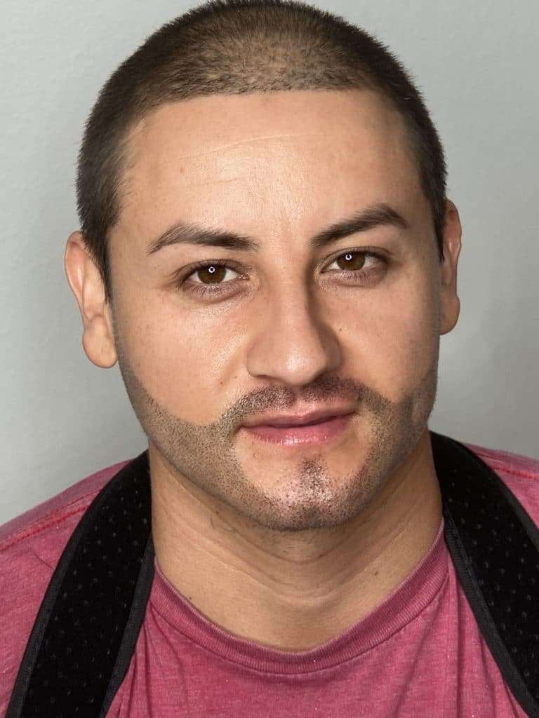 Successful appearance of beard micropigmentation