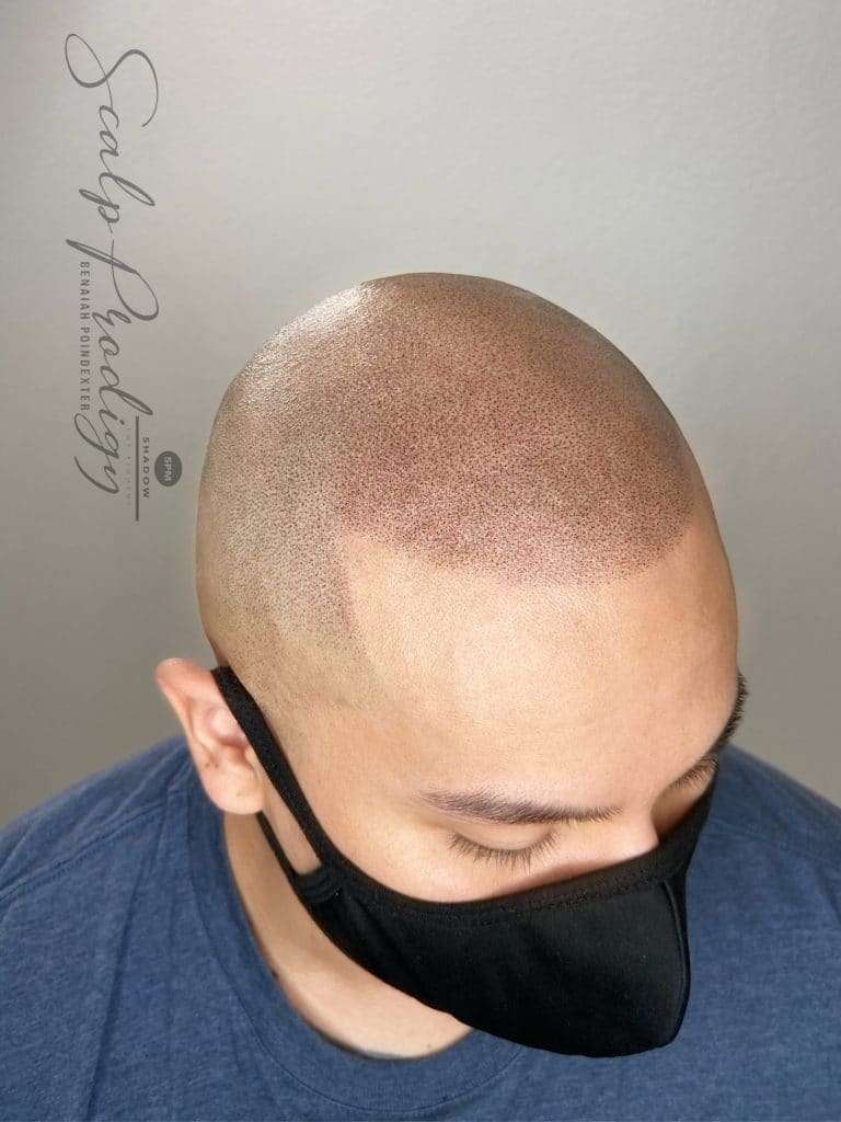 Permanent SMP treatment of bald headed person showcasing his scalp