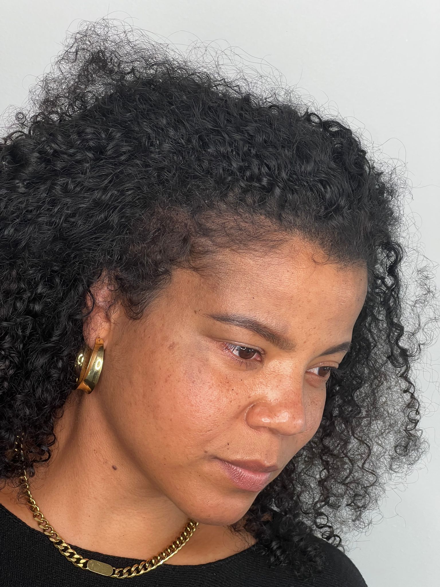 Female Scalp Micropigmentation