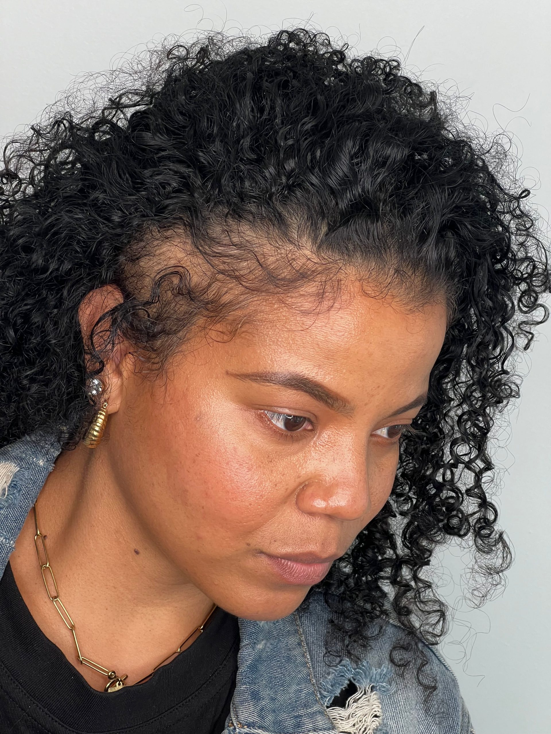 Female Scalp Micropigmentation