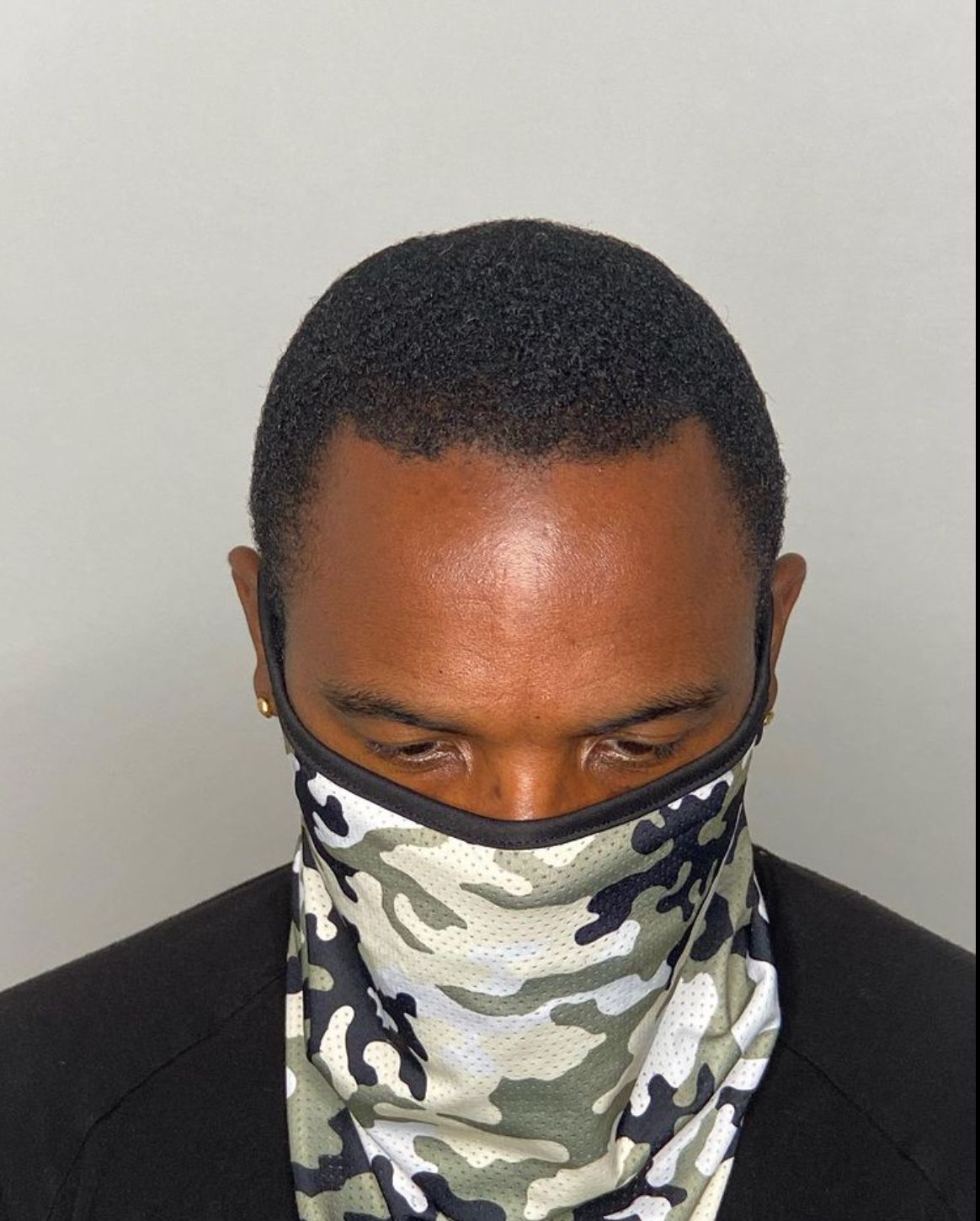 Man wearing a face mask highlighting his hairline density treatment outcomes