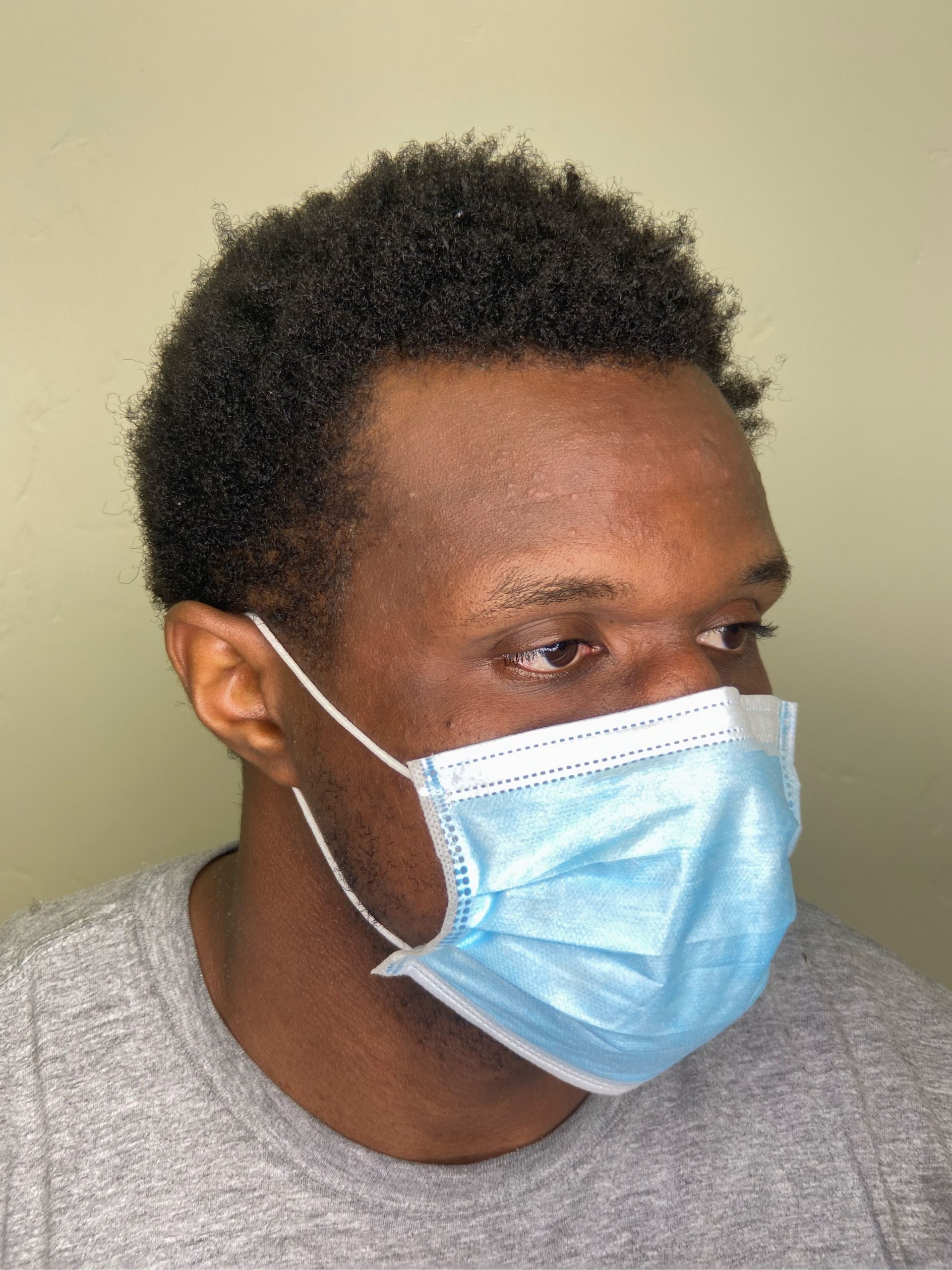 A bald man wearing a face mask, showcasing hair loss solution of curly haired