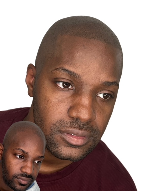 Hard Hairline
